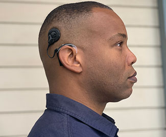 Malik's Cochlear Implant