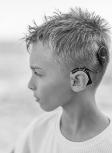 Black and white photo of a young boy wearing a cochlear implant